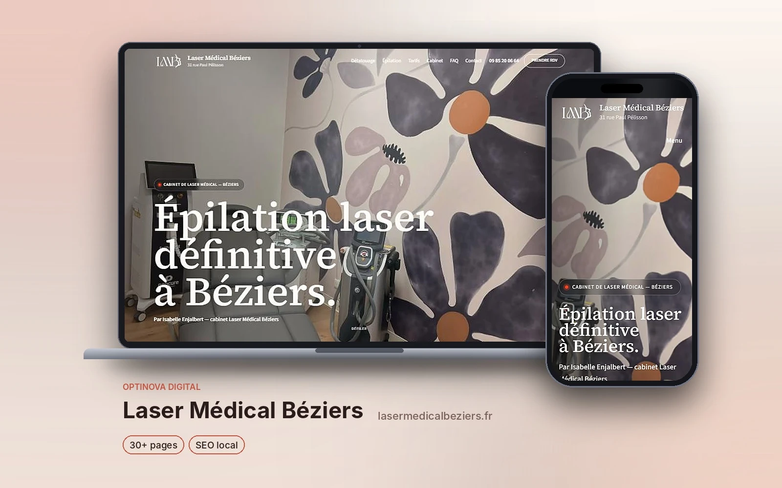 Site d’épilation laser à Béziers avec pages locales, créé par Optinova Digital